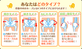 あなたの骨盤 歪んでいませんか 池川整骨院